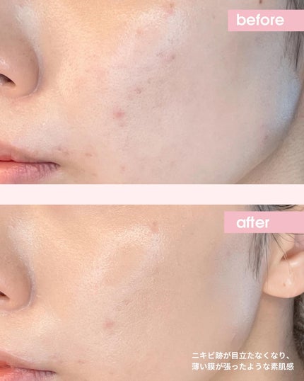 グローフィルタープライマー/MAD PEACH/化粧下地を使ったクチコミ(4枚目)