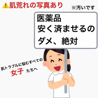 
【肌荒れの画像あり。閲覧注意です⚠️】


ニキビが気になって気になってしょうがなかった私。
今、めちゃめちゃ後悔しています……。
というのも、安く早く治したくて合わない市販薬を使ってしまったのです。