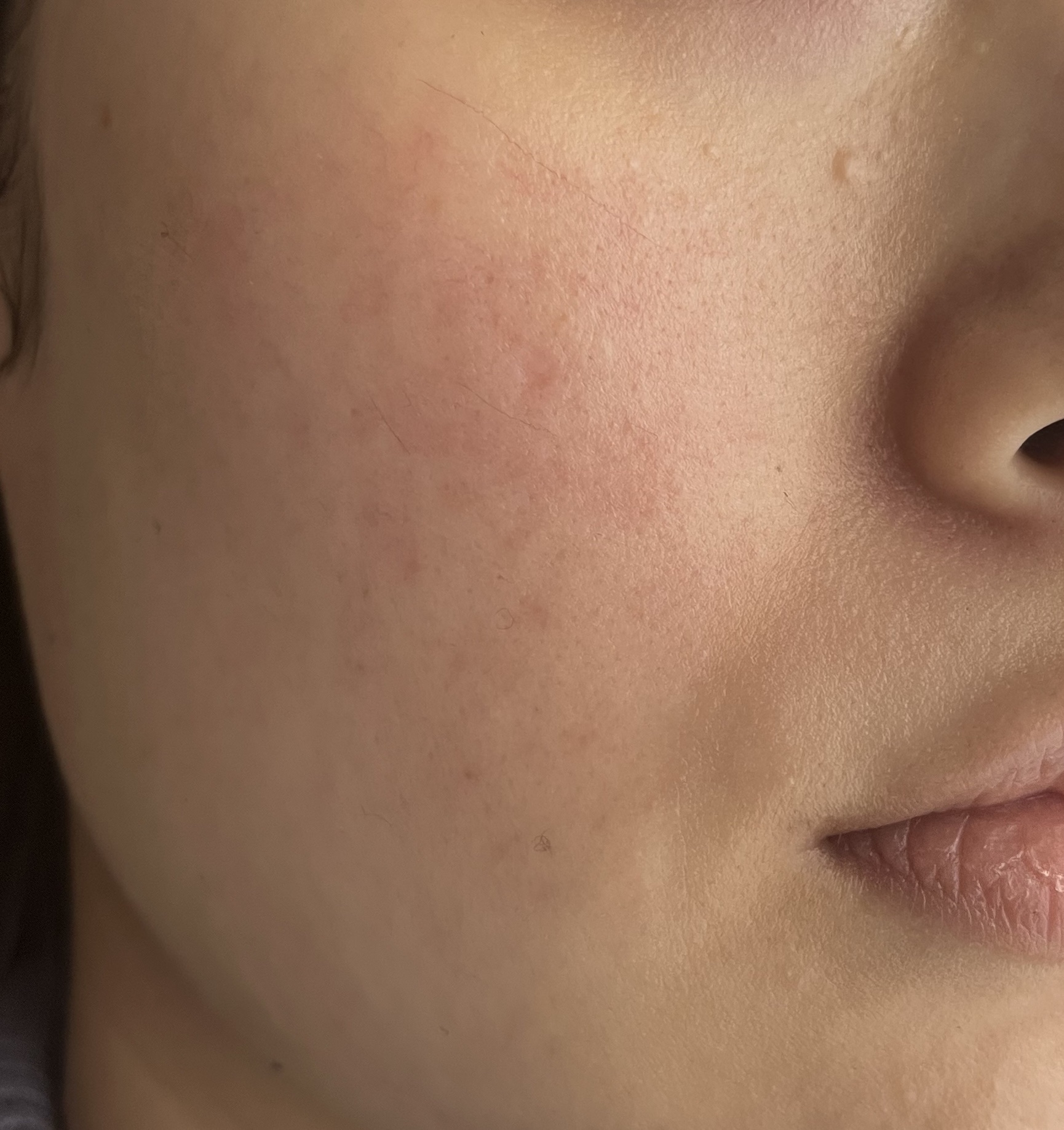 アクティブベース クリアミルク 120mL/オバジ/乳液を使ったクチコミ（2枚目）