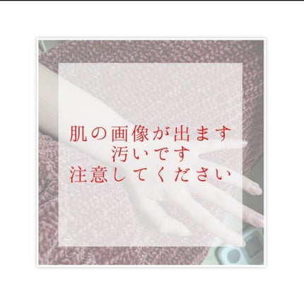 LOVE DOCK IPL光脱毛器/LOVE DOCK/家庭用脱毛器を使ったクチコミ(2枚目)