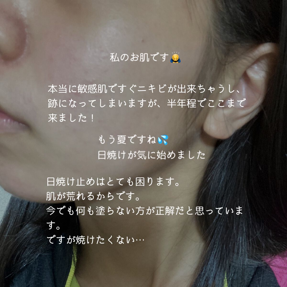 UVマイルドジェルN/マミー/日焼け止めジェルを使ったクチコミ（2枚目）