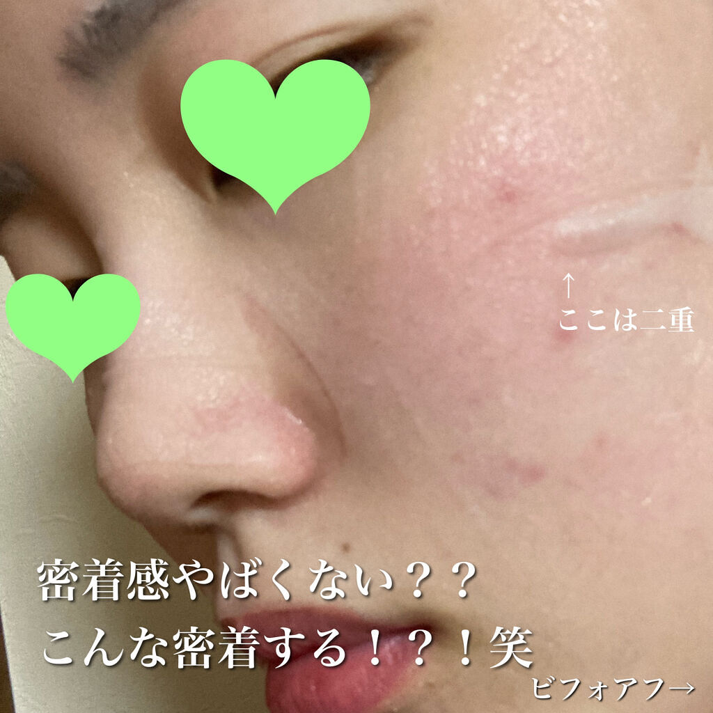 ティーツリーケアソリューション アンプルマスクJEX/MEDIHEAL/シートマスク・パックを使ったクチコミ（3枚目）