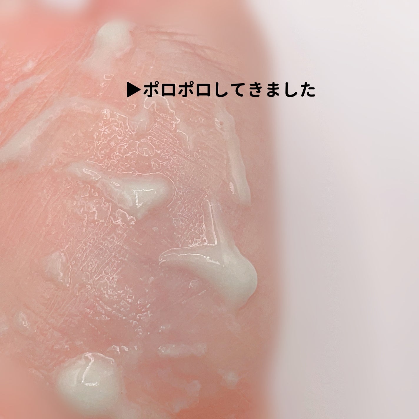 緑豆ミルクピーリングジェル/beplain/ピーリングを使ったクチコミ(4枚目)