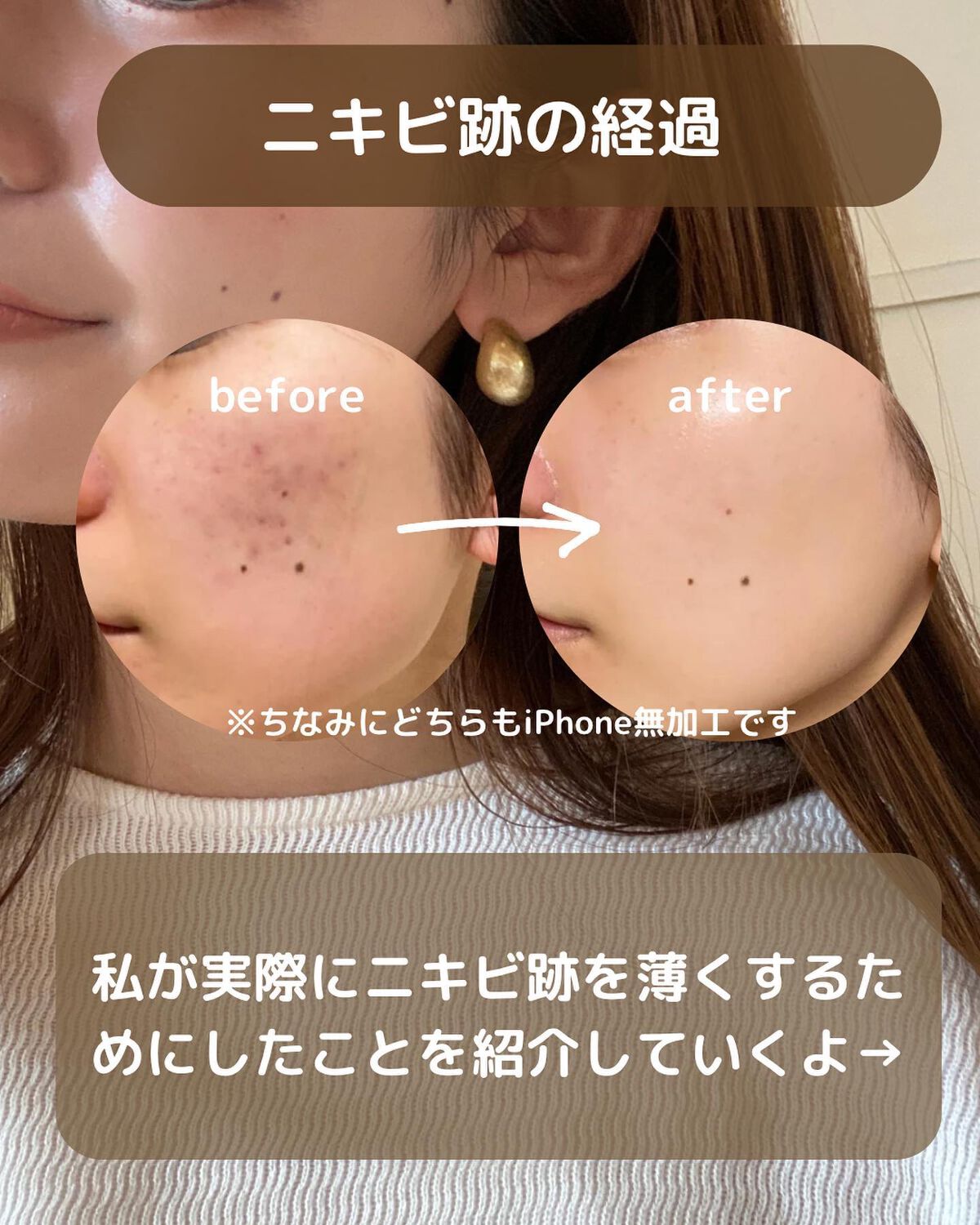 ガラクナイアシン2.0エッセンス/manyo/美容液を使ったクチコミ（2枚目）