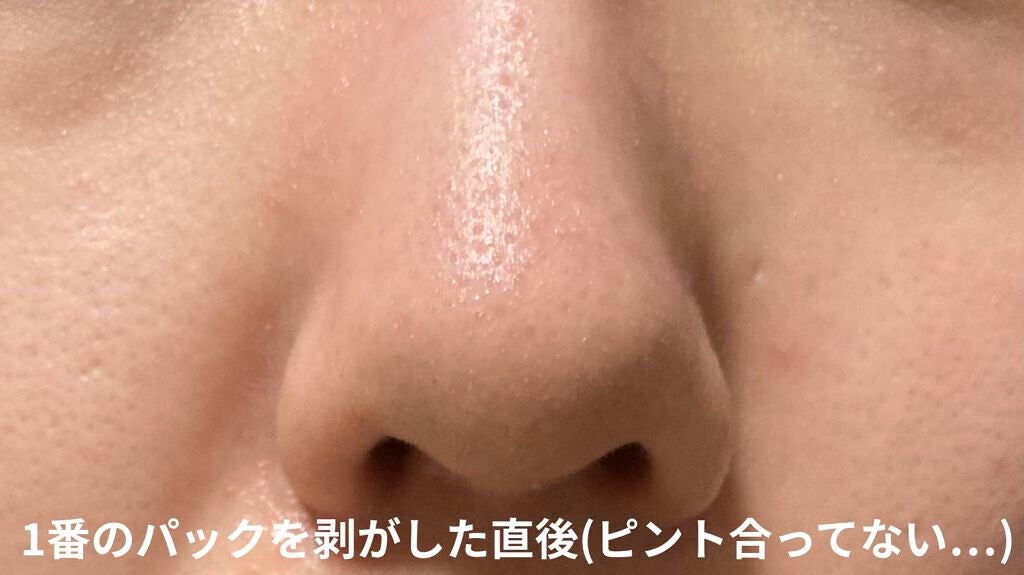 アンチポアブラックヘッドパーフェクトクリアキット/CNP Laboratory/シートマスク・パックを使ったクチコミ(3枚目)
