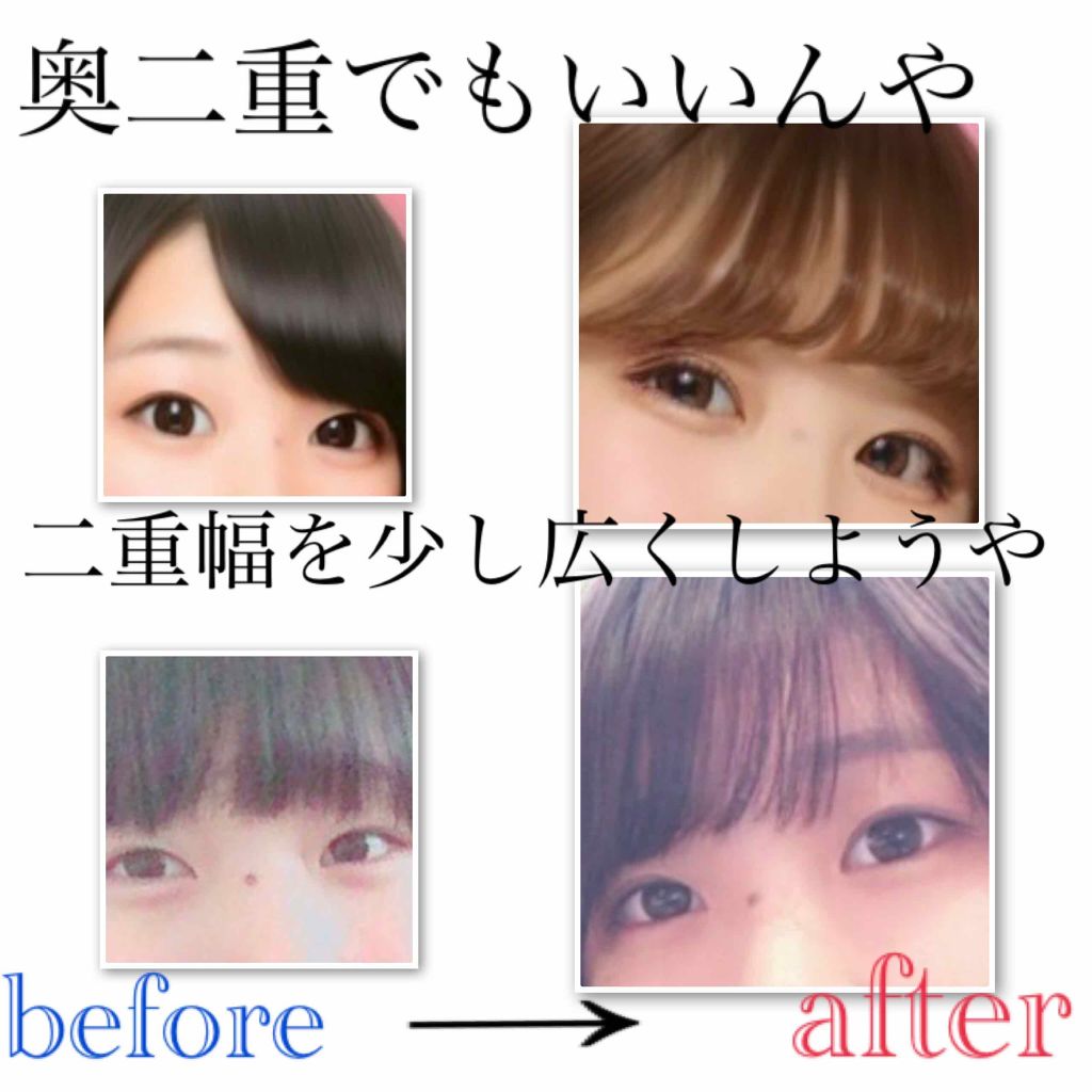 のびーるアイテープ（絆創膏タイプ、レギュラー）/DAISO/二重まぶた用アイテムを使ったクチコミ（1枚目）