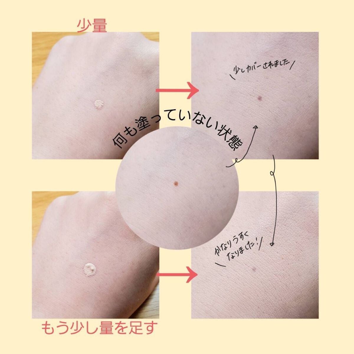 マスクフィットオールカバーデュアルコンシーラー/TIRTIR(ティルティル)/コンシーラーを使ったクチコミ(5枚目)