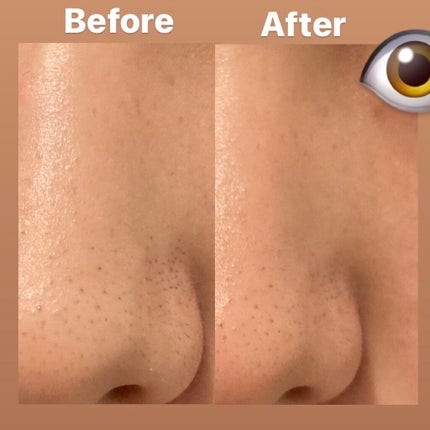 DETクリア ブライト&ピール ピーリングジェリー<無香料タイプ>/Detclear/ピーリングを使ったクチコミ(2枚目)