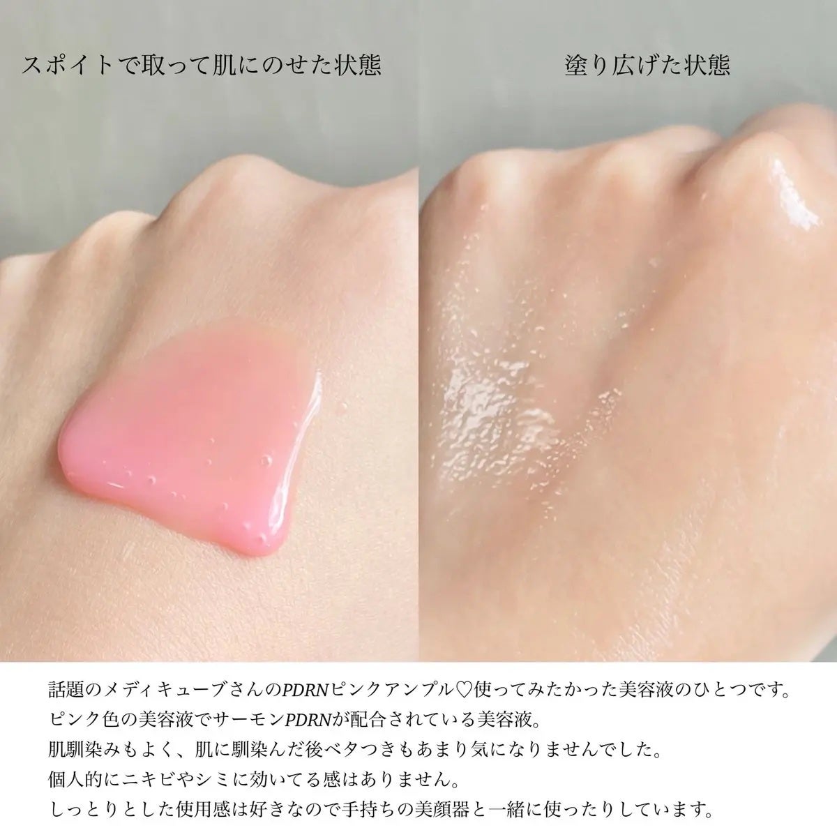 PDRNピンクアンプル PDRN 10,000ppm配合/MEDICUBE/美容液を使ったクチコミ(2枚目)