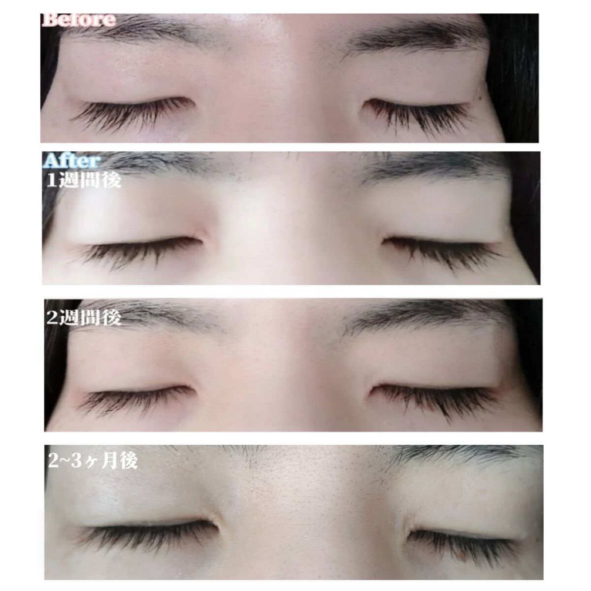 メルポス ドリームアイラッシュセラム/me repos/まつげ美容液を使ったクチコミ（3枚目）