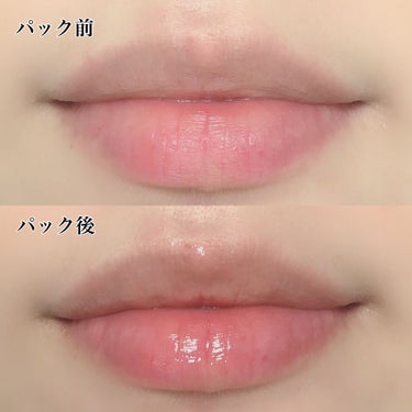 セリナ on LIPS 「唇のターンオーバーはすごく早く3~5日らしい🤔しかも角層も薄く..」（3枚目）