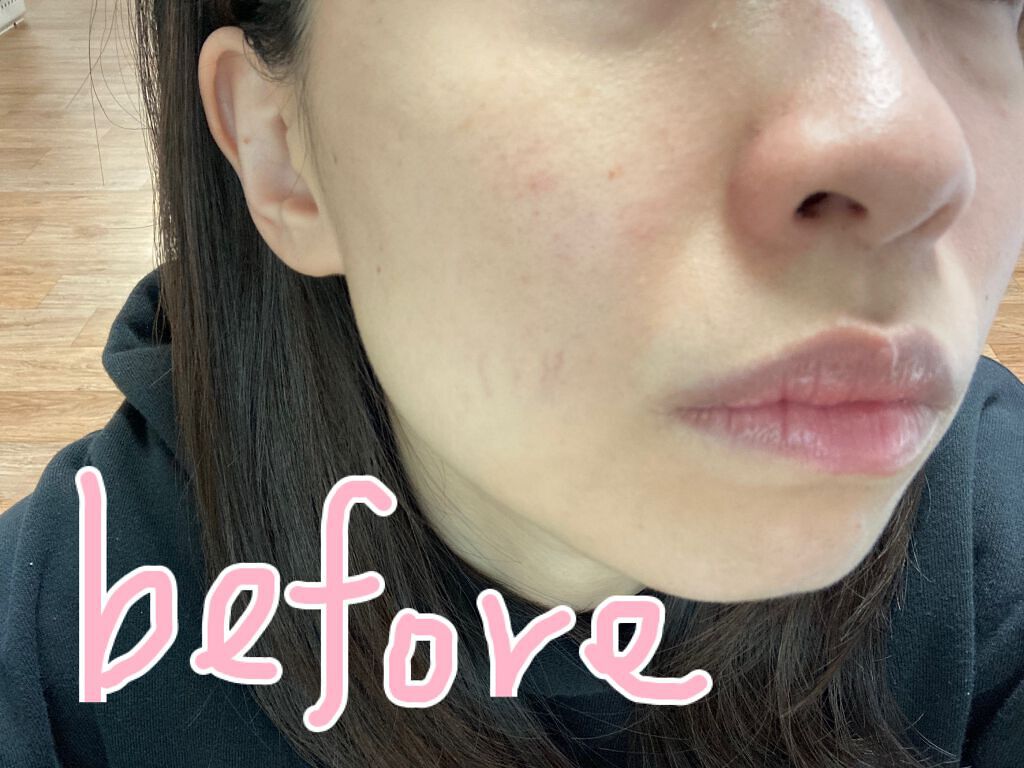 ピーチスキンフィッティングベース/espoir/化粧下地を使ったクチコミ(5枚目)