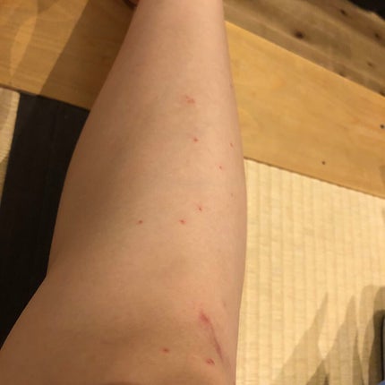 を使ったクチコミ(2枚目)