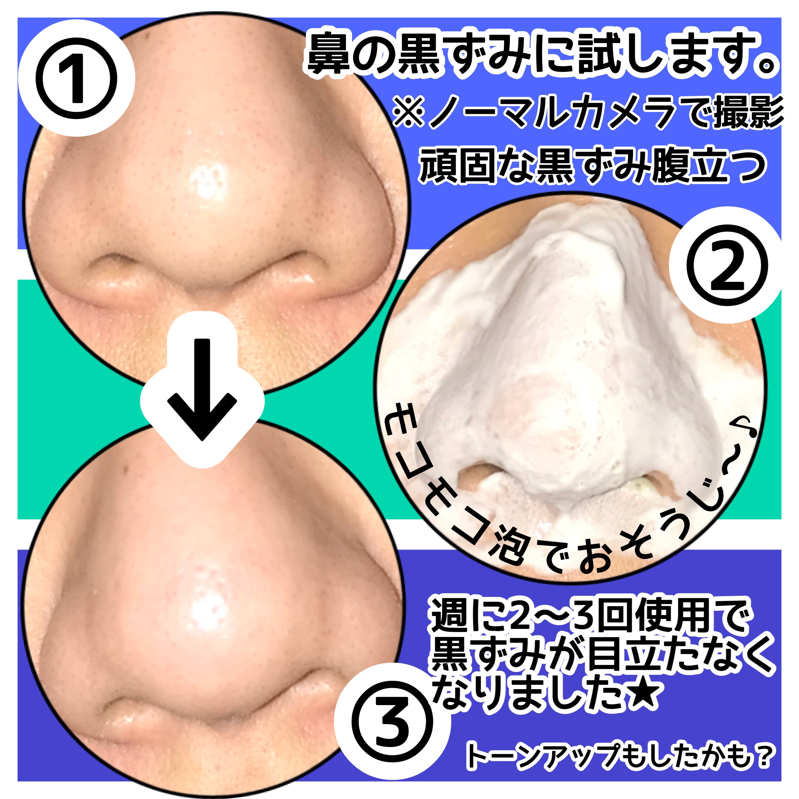 バイバイブラックヘッド グリーンティートックスバブルクレンザー/SOME BY MI/スクラブ・ゴマージュを使ったクチコミ（3枚目）