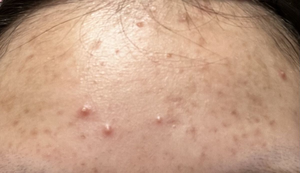 ウオーター/アベンヌ/ミスト状化粧水を使ったクチコミ（3枚目）