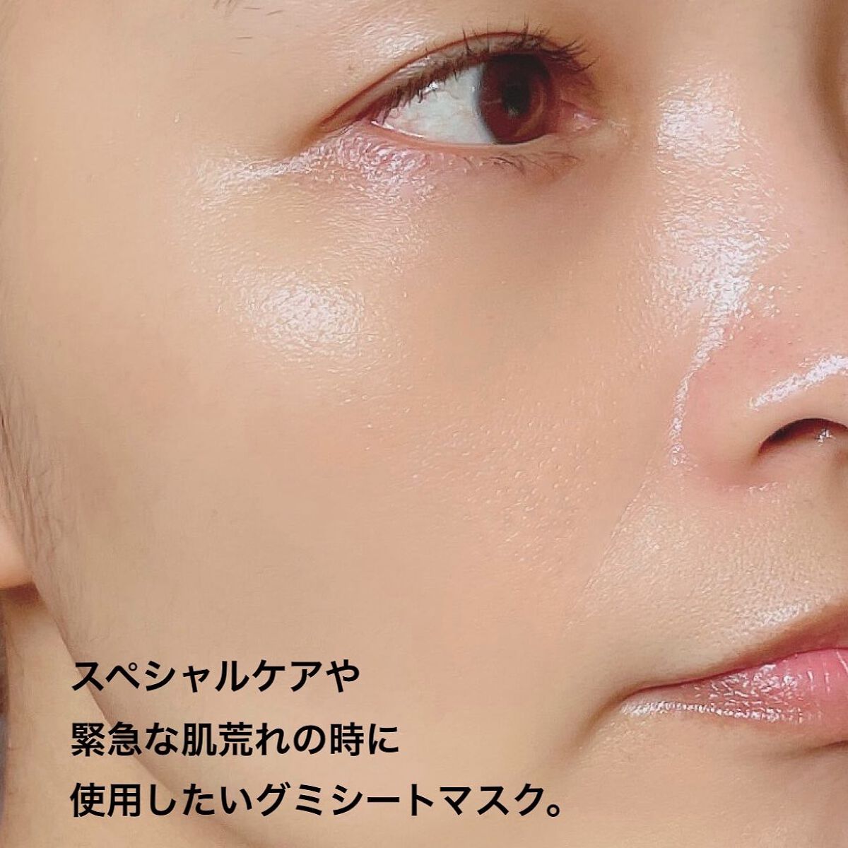 弱酸性pHシートマスク ドクダミフィット/Abib /シートマスク・パックを使ったクチコミ(5枚目)