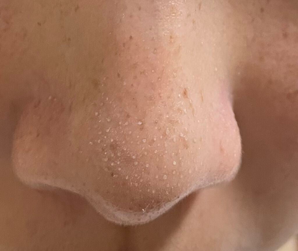 ノーモアブラックヘッド(ノーズピーリング)/One-day's you/スクラブ・ゴマージュを使ったクチコミ(6枚目)