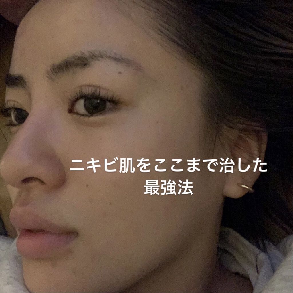 白色ワセリン(医薬品)/健栄製薬/その他を使ったクチコミ（1枚目）