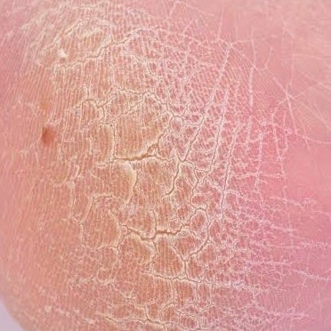 ゴウンバル クリーム/3WB/レッグ・フットケアを使ったクチコミ(2枚目)