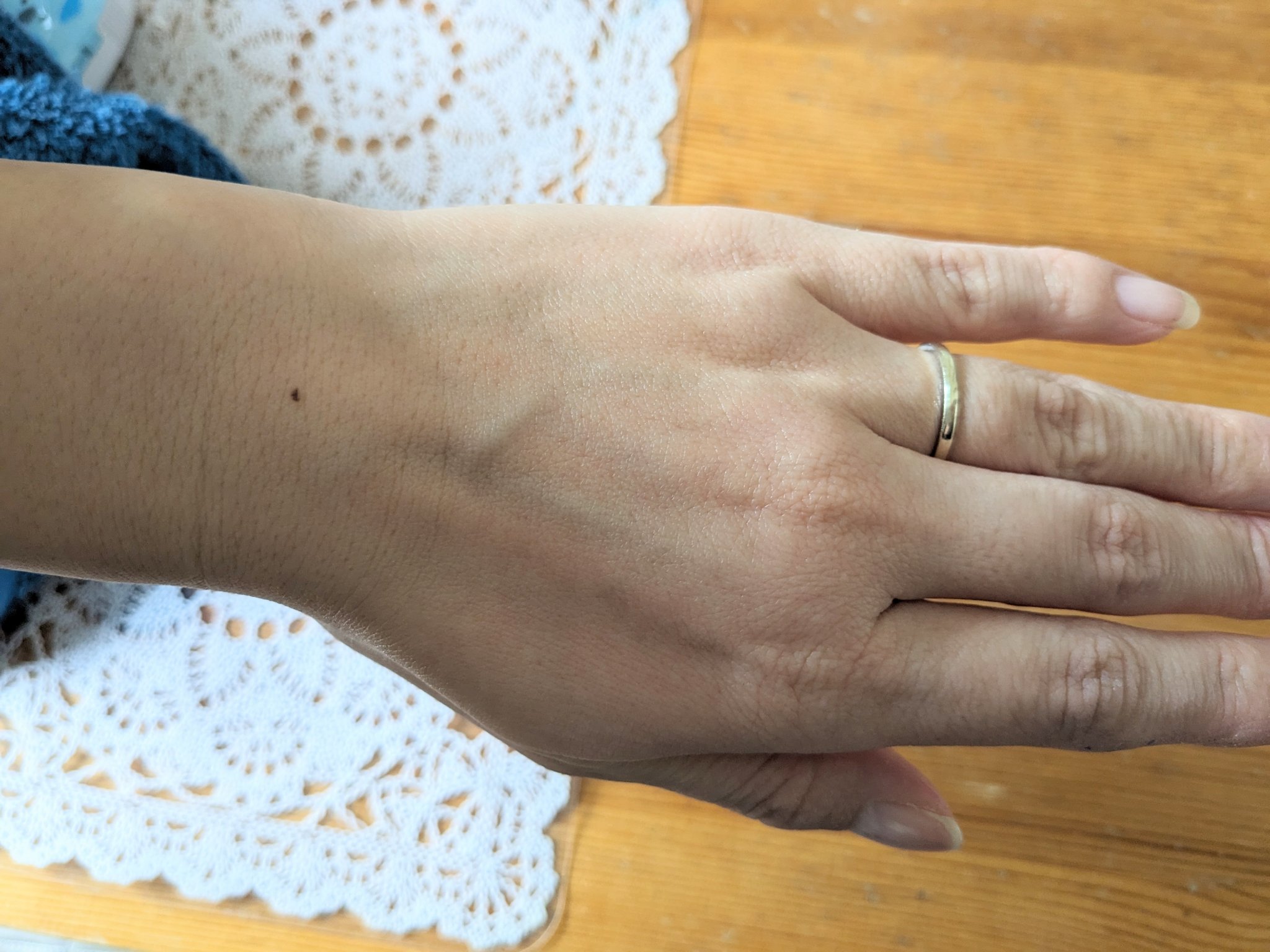 グルタチオンアンプルトナー/SKIN&LAB/化粧水を使ったクチコミ（3枚目）