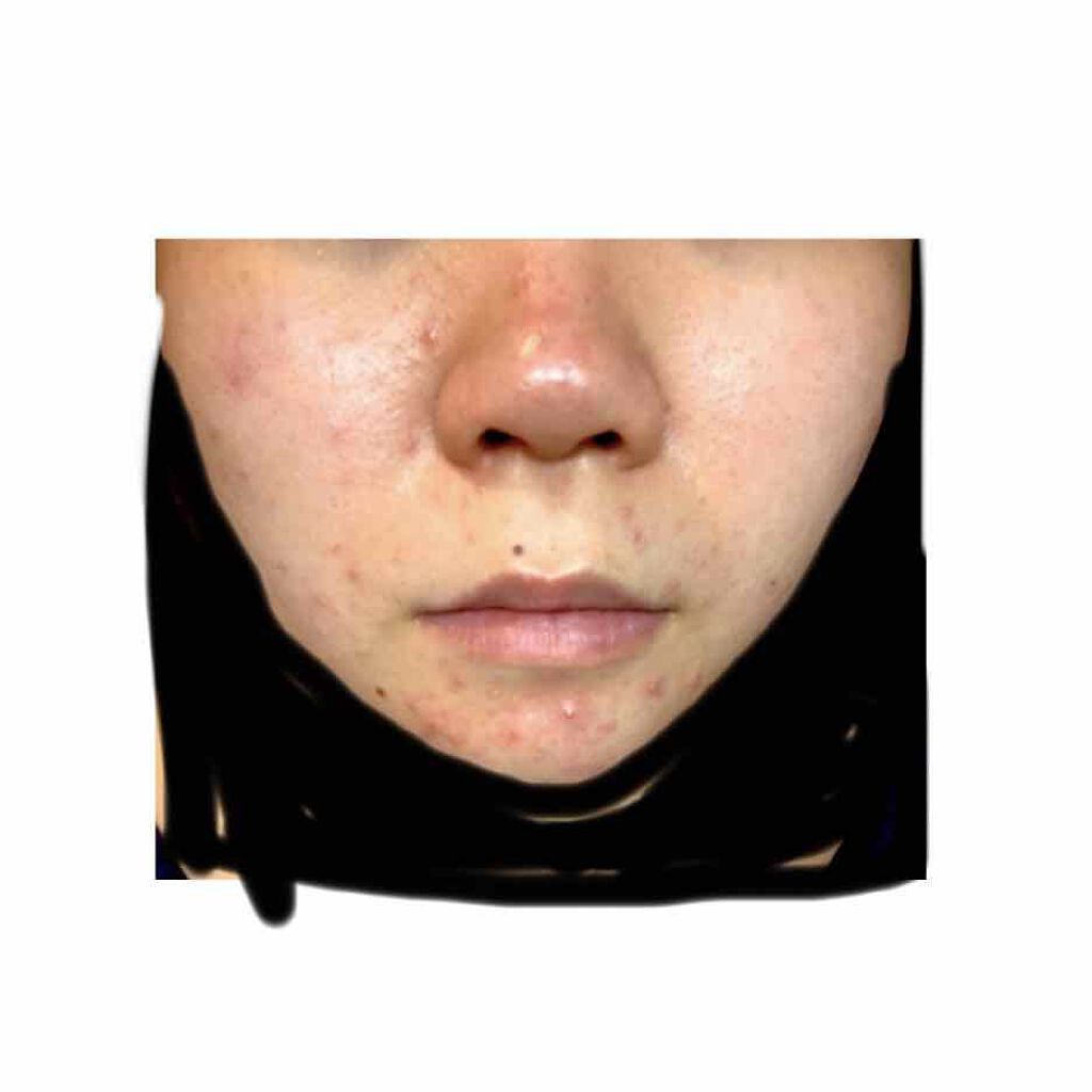 アルビオン 薬用スキンコンディショナー エッセンシャル/ALBION/化粧水を使ったクチコミ（2枚目）