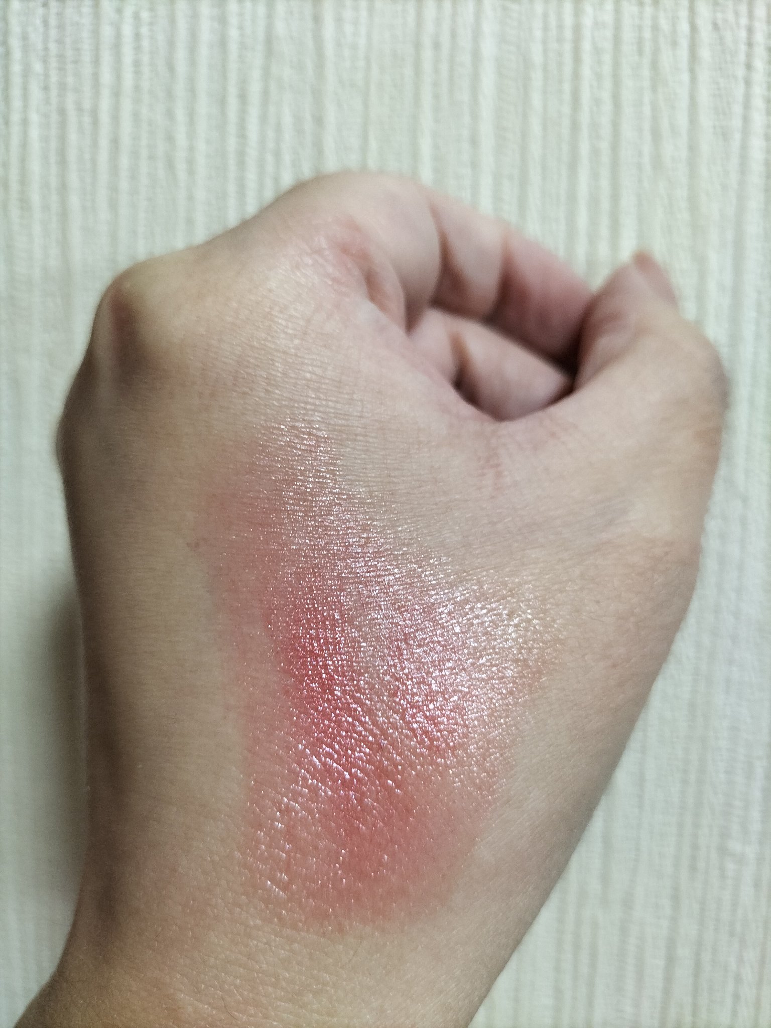 リップヴィブランス/Blistex/リップクリームを使ったクチコミ（2枚目）