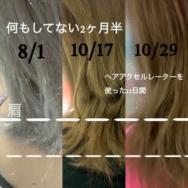 ヘアアクセルレーター フローラルの香り/加美乃素本舗/頭皮ケアを使ったクチコミ（1枚目）