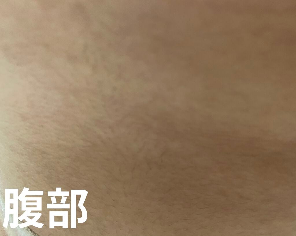 FASIZ607C IPL光脱毛器/FASIZ/家庭用脱毛器を使ったクチコミ(4枚目)