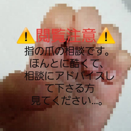 ハンドベール プレミアムリッチネイル/メンソレータム/ネイルオイル・トリートメントを使ったクチコミ(1枚目)