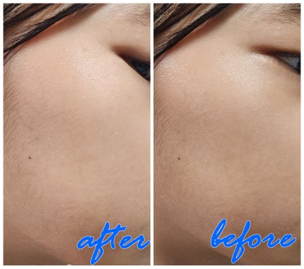 レチノール スーパーバウンス セラム/IOPE/美容液を使ったクチコミ(4枚目)