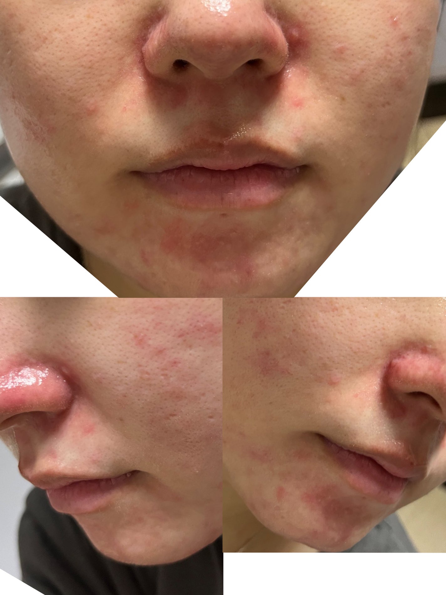 明色美顔水 薬用化粧水/美顔/化粧水を使ったクチコミ(2枚目)