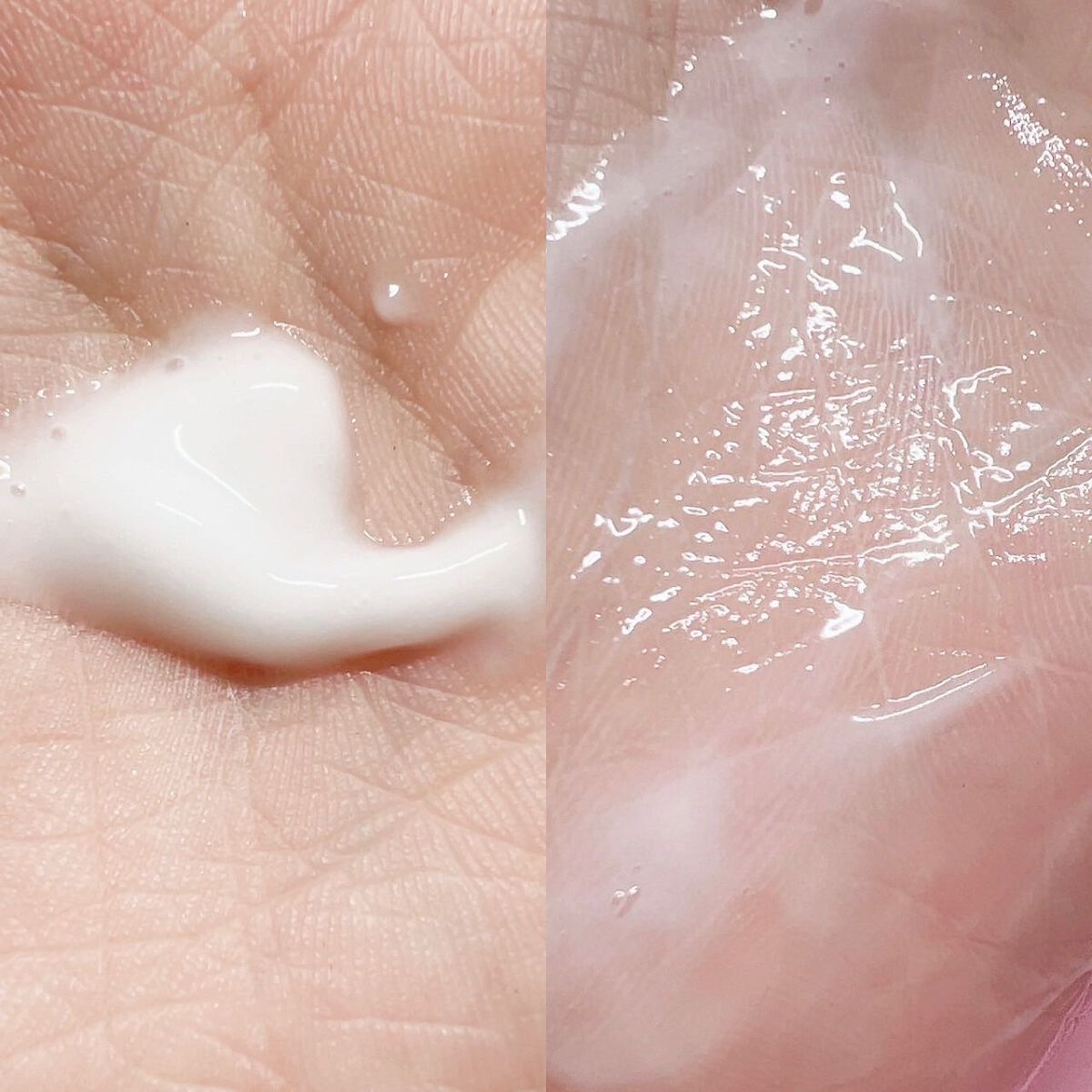 ヘパトリート 薬用保湿ミルククリーム/ゼトックスタイル/ボディクリームを使ったクチコミ（3枚目）