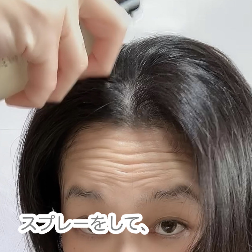 MEDICATED SCALP ESSENCE/La chicyou/頭皮ローションを使ったクチコミ（3枚目）