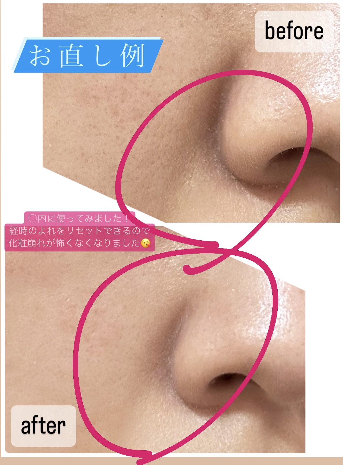 アンリミテッド コンシーラー 3 ライト/shu uemura/リキッドコンシーラーを使ったクチコミ（3枚目）