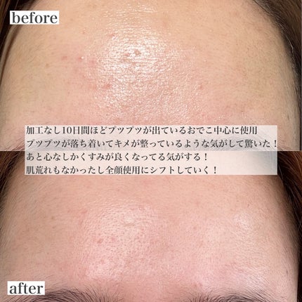 リードルショット300/VT/美容液を使ったクチコミ(8枚目)