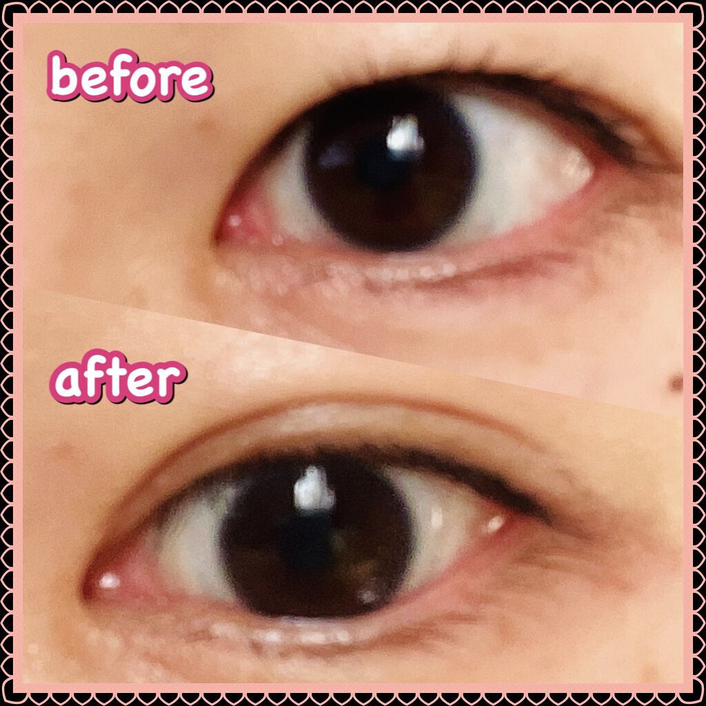 オリシキ アイリッドスキンフィルム		/D-UP/二重まぶた用アイテムを使ったクチコミ（2枚目）