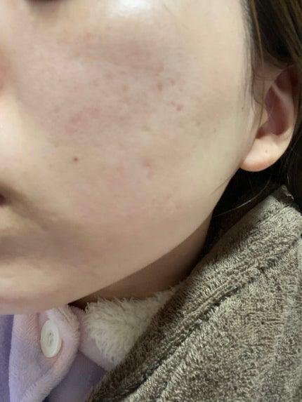 天使の優しさ/ラッシュ/その他洗顔料を使ったクチコミ(4枚目)