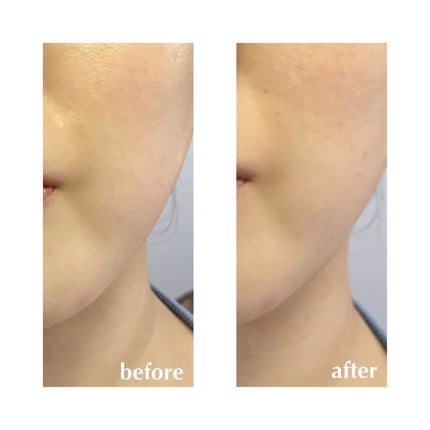 PLUMINUS/mous./美顔器・マッサージを使ったクチコミ(3枚目)