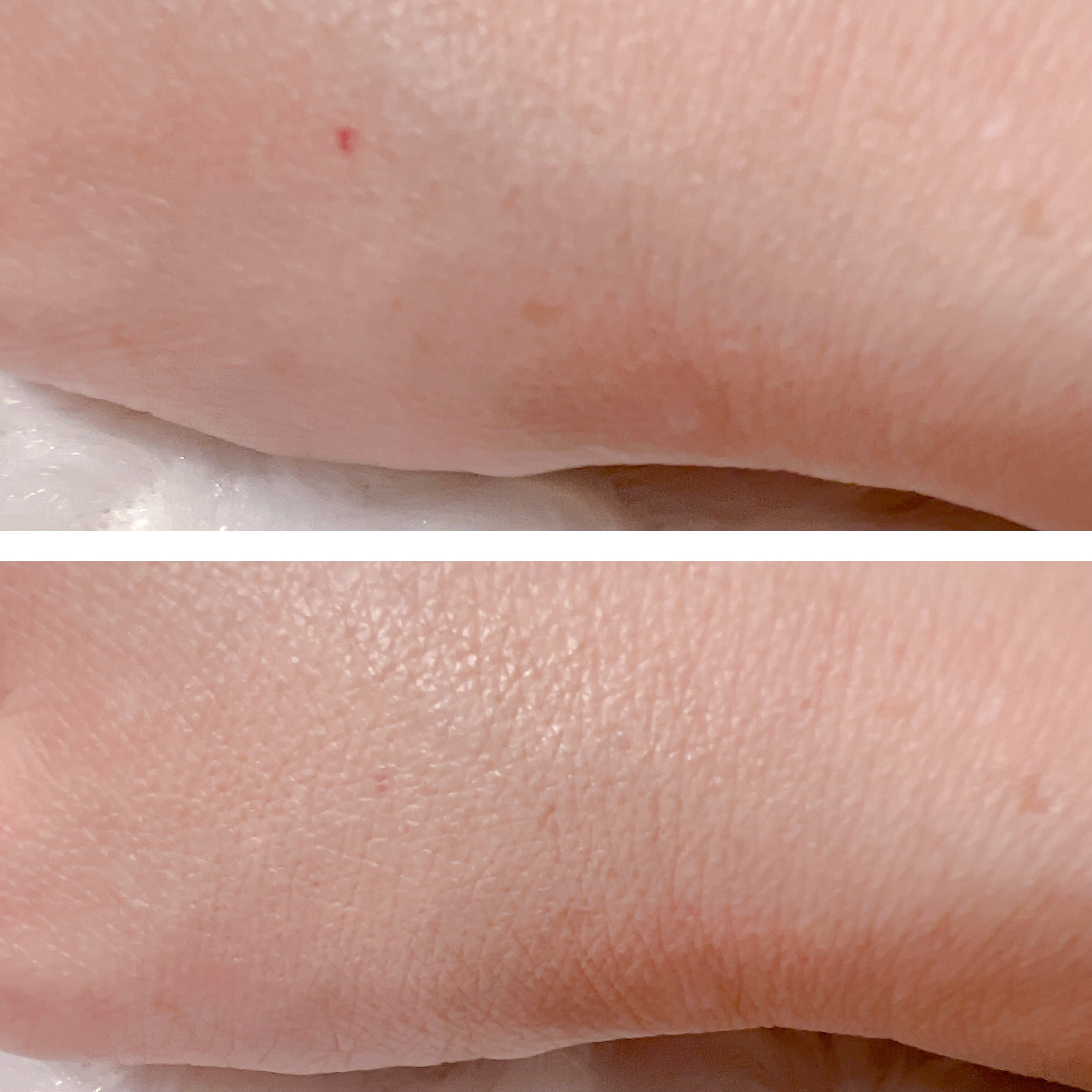 ダーマシンコンシーラー/23years old/リキッドコンシーラーを使ったクチコミ（3枚目）