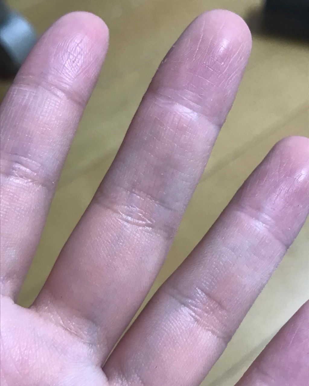 ユースキンA ファミリーメディカルクリーム/ユースキン/ハンドクリームを使ったクチコミ(3枚目)