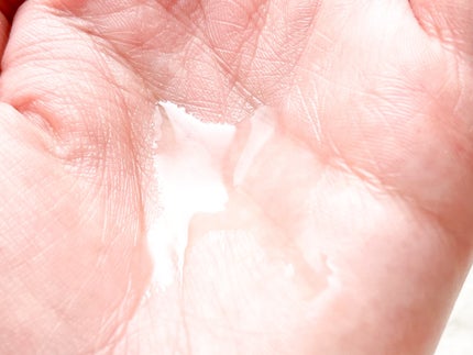 VC100エッセンスローション EX/ドクターシーラボⓇ/化粧水を使ったクチコミ(3枚目)