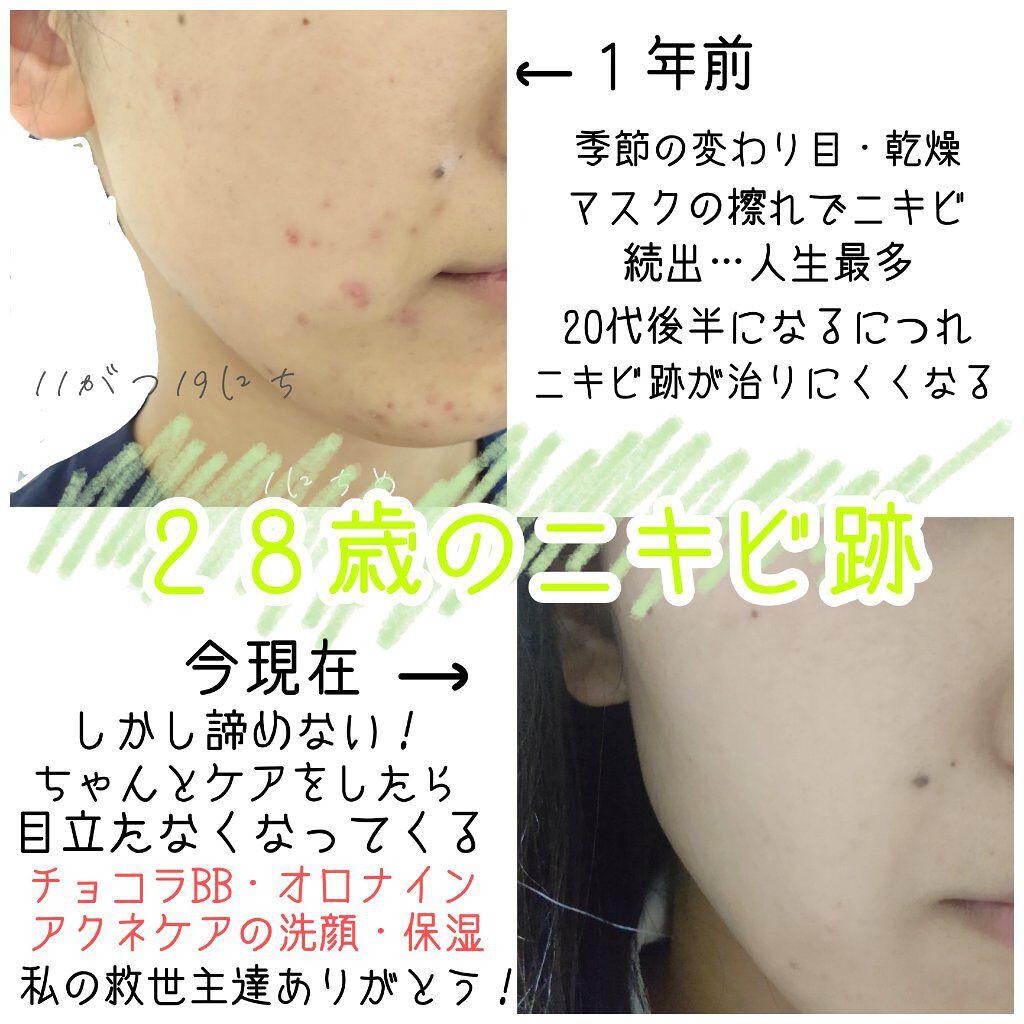 チョコラBBプラス (医薬品)/チョコラBB/その他を使ったクチコミ（1枚目）