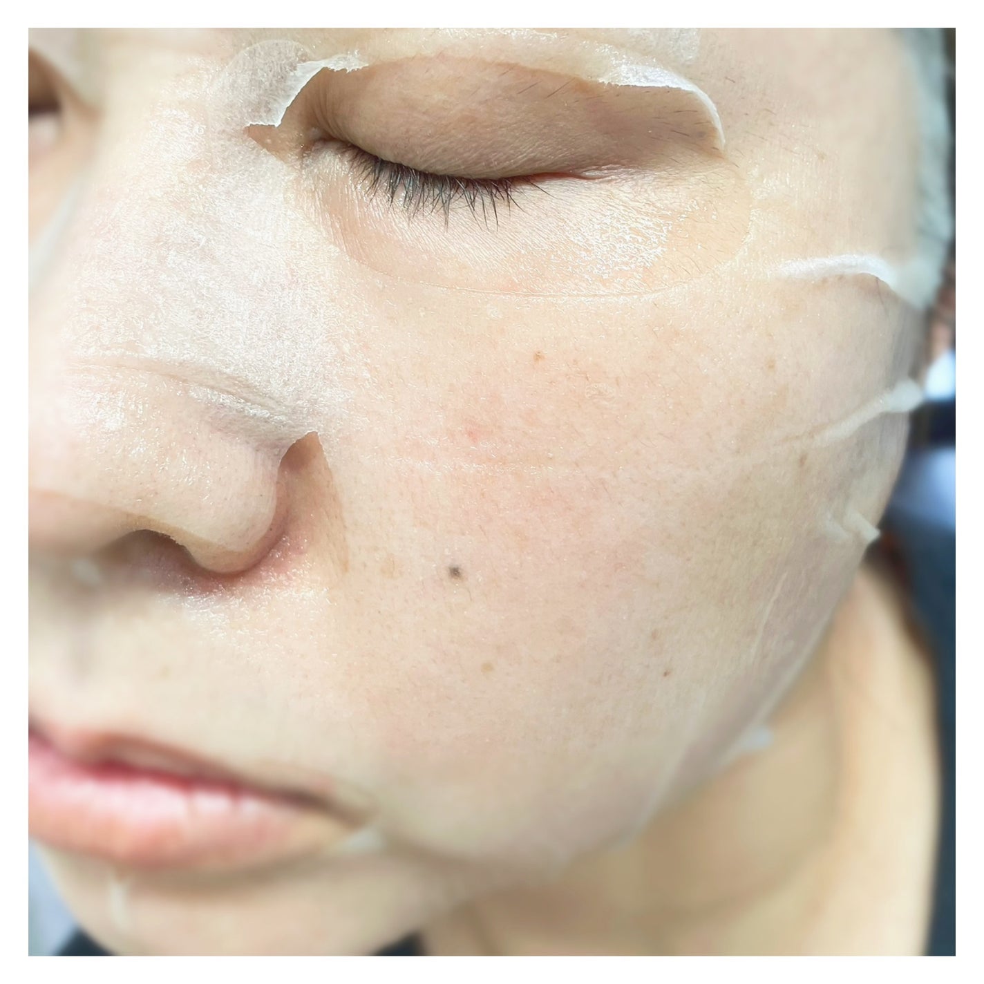 シカアルブチンマスク/NOWATER/シートマスク・パックを使ったクチコミ(9枚目)