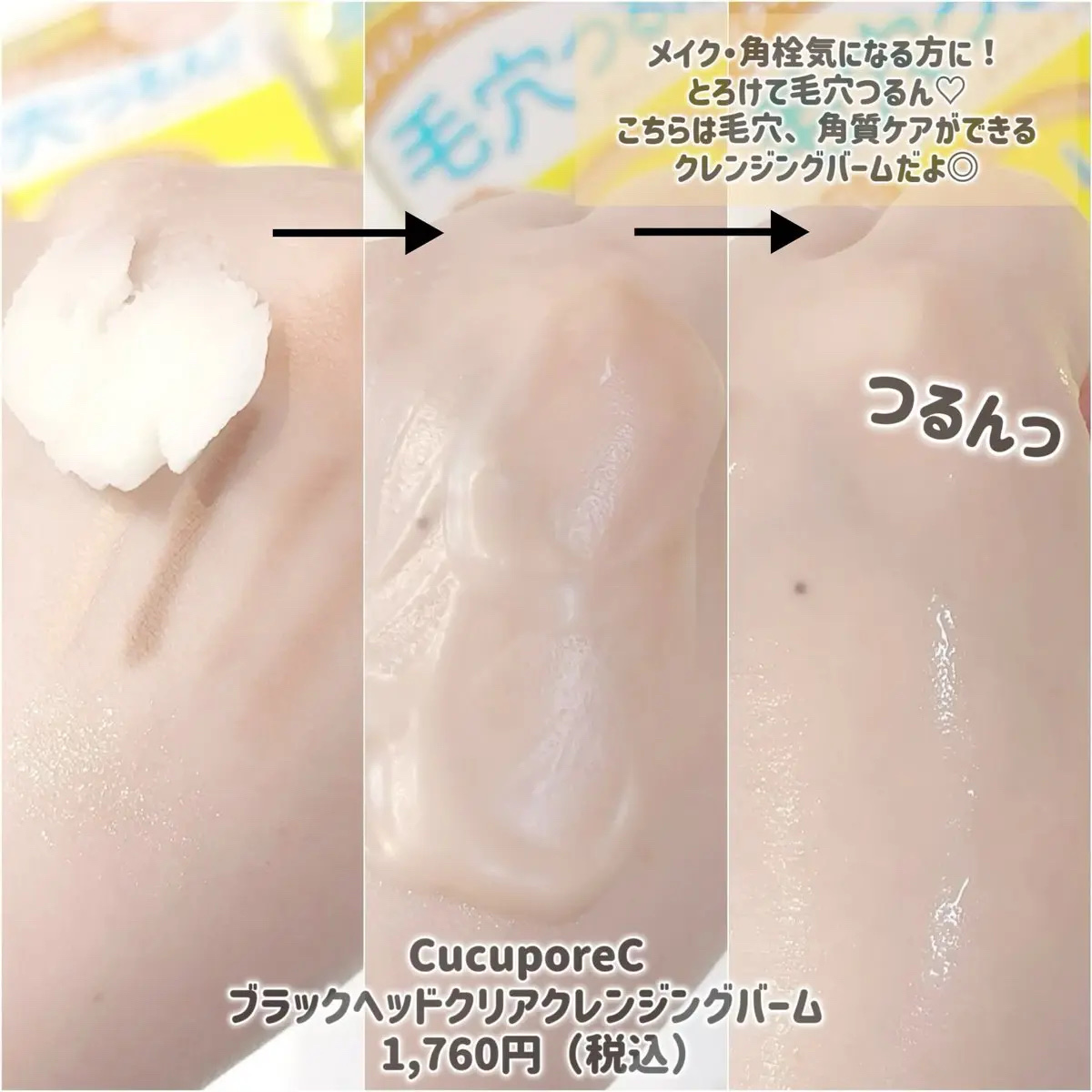 ブラックヘッドクリアクレンジングバーム/CucuporeC/クレンジングバームを使ったクチコミ（3枚目）
