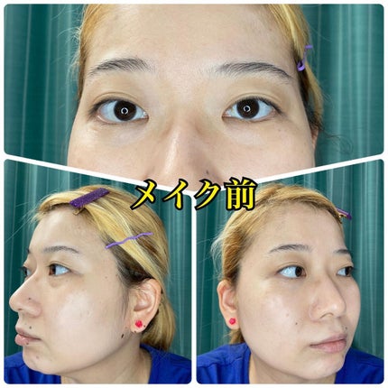 薬用クリアエステヴェール/Macchia Label/リキッドファンデーションを使ったクチコミ(8枚目)