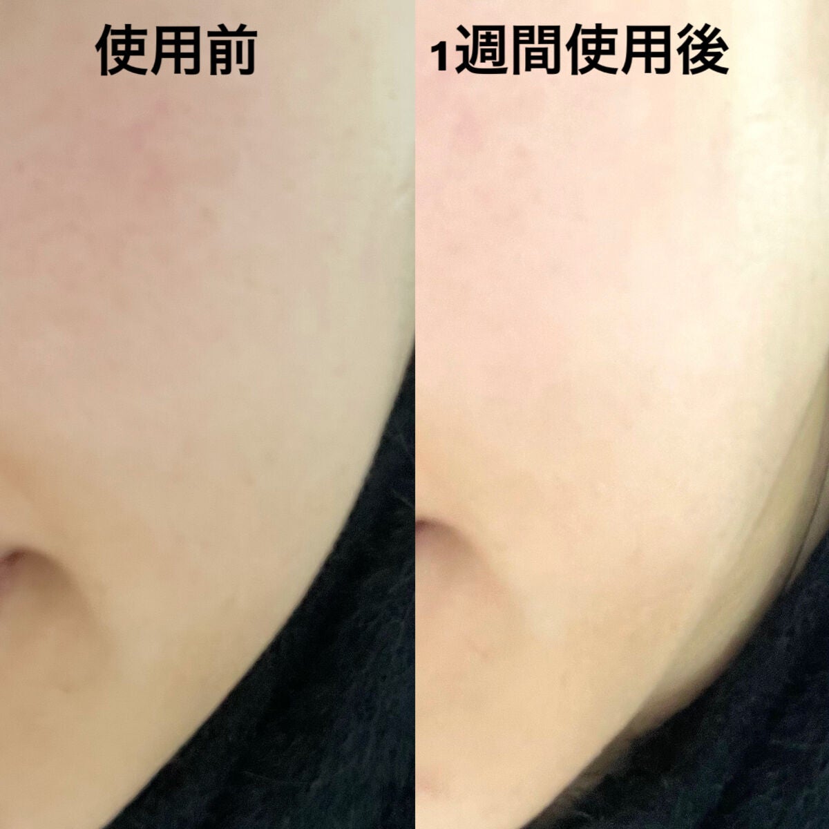 ユース ラディアンス ビタチノール セラム/primera/美容液を使ったクチコミ(4枚目)