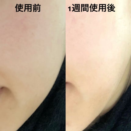 ユース ラディアンス ビタチノール セラム/primera/美容液を使ったクチコミ(4枚目)