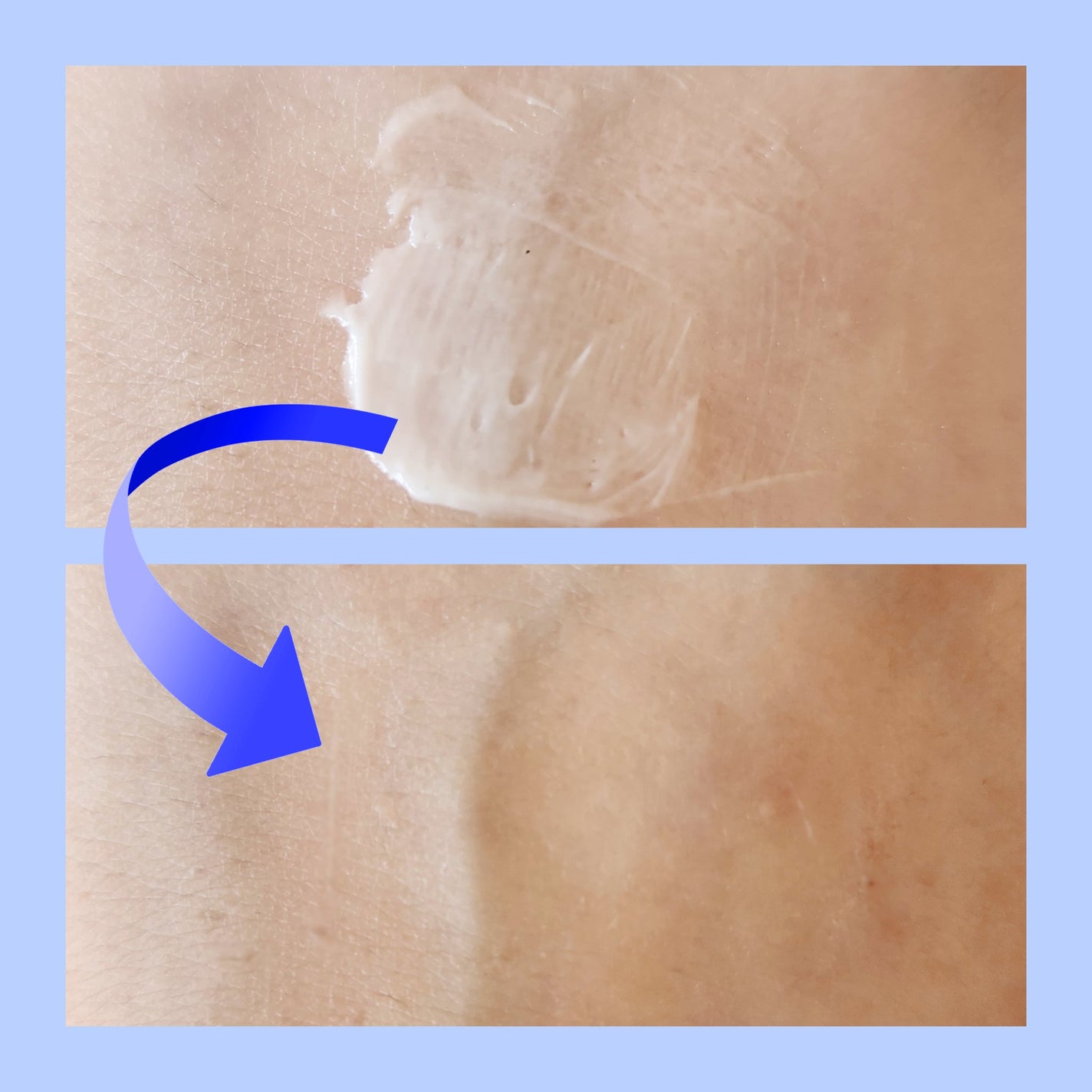 A.Cクリーム プレミアム/LEPOREM/フェイスクリームを使ったクチコミ(4枚目)