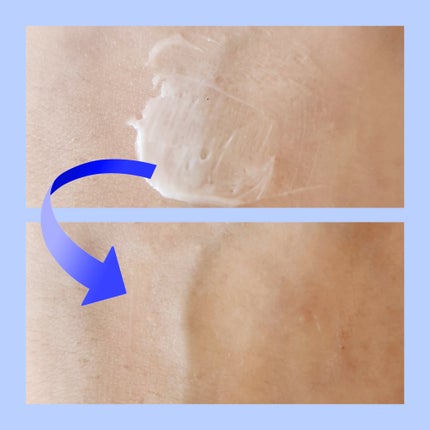 A.Cクリーム プレミアム/LEPOREM/フェイスクリームを使ったクチコミ(4枚目)