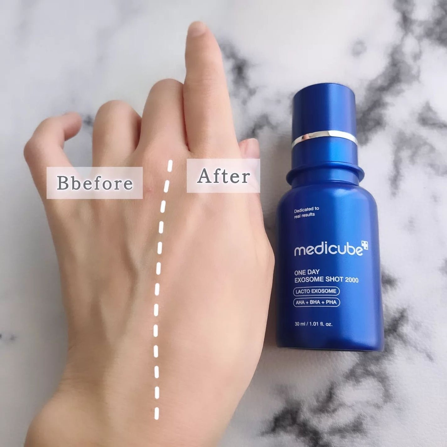 ゼロ1DAYエクソソームショット2000/MEDICUBE/美容液を使ったクチコミ(7枚目)